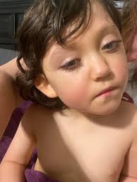 Mother saves choking baby from object