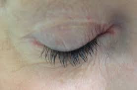 There are many things that you could be allergic to that could cause this including cosmetics, hair coloring, nail polish, food allergies, perfumes, etc. Red Eyelids Tips For Facial And Eyelid Contact Dermatitis