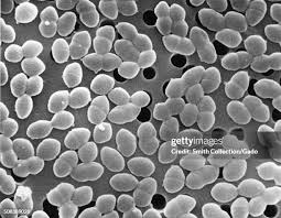 Image result for Group D Streptococcus