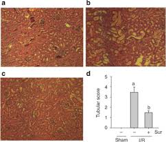 Image result for Suramin