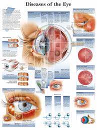 A3 Medical Poster Diseases Of The Human Eye Text Book Anatomy Pathology Diseases Of The Eye Eye Facts Medical Posters