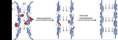 27 nisan e muhtırasını yayınlayan o dönemin vesayetçi darbeseverlere cevap nasıl verilmişse bugün chp ve avanesi hariç siyaset. Strategies To Enhance Blood Vessel Perfusion And Drug Penetration Download Scientific Diagram