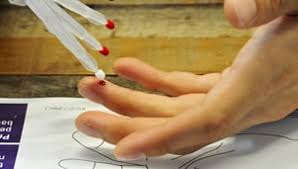 Image result for Capillary Puncture