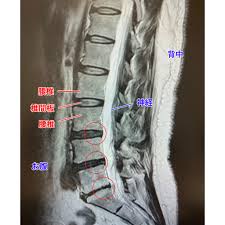 野中腰痛クリニック