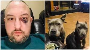 Thursday night, I was sitting in my garage smoking a cigarette. Horrible  habit, I know. 4 young men rushed me, decided they wanted my car, beat me  up, and wanted my keys.