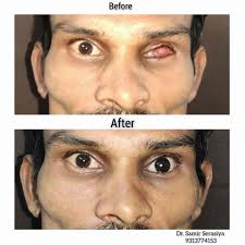 Ent Doctors in Ajwa Road, Vadodara