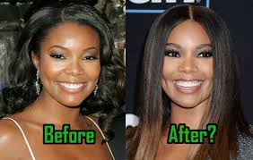 Check spelling or type a new query. Gabrielle Union Plastic Surgery Did She Have Nose Job Celebritysurgeryicon