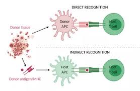 Image result for Transplant Rejection