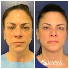 Skin Rejuvenation Archives