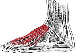 Extensor Tendonitis Causes Symptoms Treatment