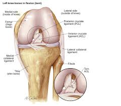 The acl or anterior cruciate ligament, connects the leg bone to the knee. Acl Injuries Acl Injury Prevention Treatment