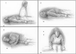 Image result for Canalith Repositioning Procedure