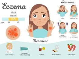 Penyakit eczema mempunyai pertalian genetik di mana jika salah seorang sama ada eczema kronik. Penyakit Ekzema Kulit Merekah Berakhir Selepas Rawatan Pakar