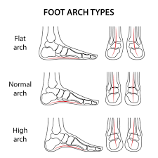 Maybe you would like to learn more about one of these? Flat Feet Peninsula Podiatry