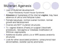 Müllerian agenesis refers tot he failure of the müllerian duct to form. Amenorrhea Amy Byerly D O Contemporary Ob Gyn