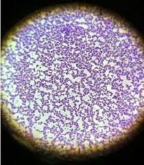 Many are hemolytic (attack red blood cells) 4. Gram Stained Smear Showing Gram Positive Cocci In Clusters Download Scientific Diagram