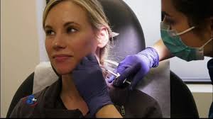 Facebook-botox-fillers