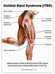 Tendonitis is when a tendon swells (becomes inflamed) after a tendon injury. All About Tendinitis