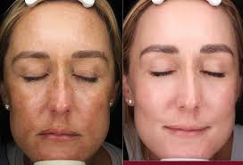 Dr Nina Wines Medical & Laser Dermatologist Sydney