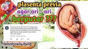 Berbagai syarat naik pesawat yang harus dipenuhi selama pandemi. Bagaimana Agar Plasenta Previa Atau Plasenta Dibawah Bisa Berputar Naik Keatas Dot Pande Youtube