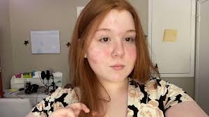 Should I return to ginger? : r/coloranalysis