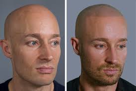 I don't really understand what the big deal with that is. Bald Guy Hair Tattoos