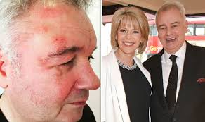 Eamonn holmes jokingly 'unplugged' his wife ruth langsford after she repeatedly interrupted him on this morning on thursday. Eamonn Holmes Twitter This Morning Star Reveals Major Family News After Health Troubles Celebrity News Showbiz Tv Express Co Uk