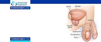Testicles, or testes, make male hormones and sperm. Testicular Cancer Test Test For Testicular Cancer Iranian Surgery