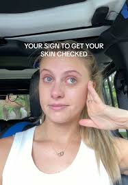 Importance of Annual Skin Checks for Melanoma Prevention