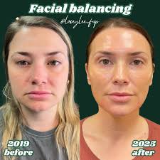 𝕃𝕒𝕔𝕖𝕪 𝕎𝕚𝕝𝕤𝕠𝕟 l filler + botox + facial balancing (@laceylee_fnp)  · Phoenix, AZ