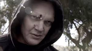 Compound Fracture (Review)