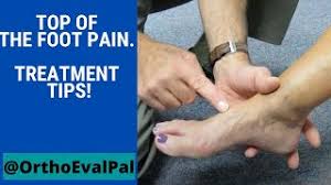3rd metatarsal fractures rarely occur in isolation. Top Of The Foot Pain Treatment Tips Youtube