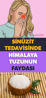Sinuzit Tedavisinde Himalaya Tuzunun Faydasi Nedir Bayanlar Bilir Saglikli Yasam Tarzi Dogal Saglik Saglikli Yasam
