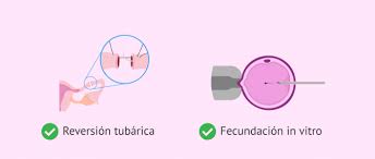 Posibilidad De Embarazo Con Una Ligadura De Trompas De Falopio