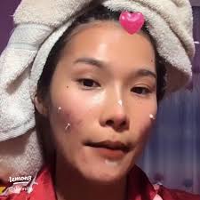 When acne is "used" or "not used," Moyce?