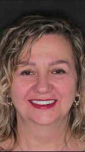 Zapraszamy już jutro do Pytania na Śniadanie 📺, 🗓 środa 29. maja 2024, 🕙  godz. 9:50, 📍 TVP2, #DrSobczak #SobczakConcept #ZebyNaStale #TrzecieZeby  #FullArch #Implanty