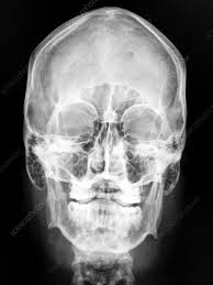 Image result for Skull XRay