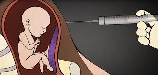 Resultado de imagen para aborto