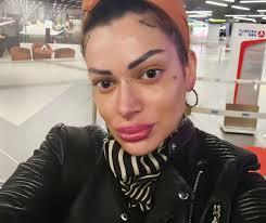 Dunja Ilić pretučena a za sve krivi dečka