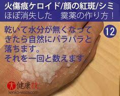なんと 火傷痕ケロイドや顔の紅斑もほぼ消失する霙 みぞれ 薬の作り方12 ケロイド 顔 シミ 消す 傷跡 消す