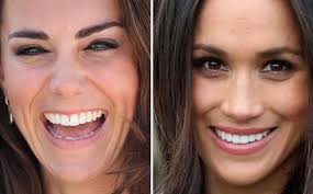 Kate Middleton News: 'Imperfect' Teeth Reflect A 
