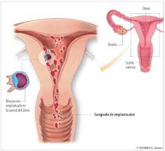 Sangrado De Implantacion Tus 20 Dudas Resueltas Natalben