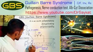 It can lead to paralysis, which is usually. Guillain Barre Syndrome Gbs Pathogenesis C F Investigations Treatment Dr Saykat Youtube