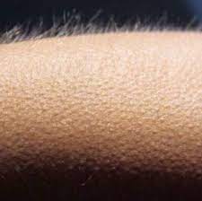 See a recent post on tumblr from @taechnological about goosebumps meme. Whisper In Ear Goosebumps Know Your Meme