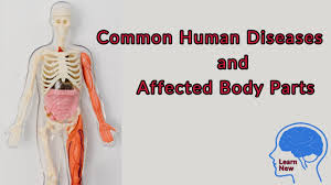 The ph of saliva is ranges from 6.5 to 7.5. Diseases And Affected Body Parts Gk In English Common Human Diseases Youtube