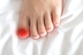 So, dress the affected toe well, and change the dressings often to. Signs Your Ingrown Toenail Is Infected Southwest Florida Podiatrist