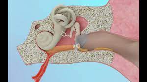 Top 7 Causes Of A Clogged Ear With Minimal To No Pain Youtube