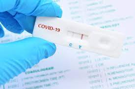 Les laboratoires estiment que cette mesure pourrait freiner la production de doses. Covid 19 Tests Antigeniques Dans Les Pharmacies De Toulouse Les Conditions Pour Se Faire Tester Actu Toulouse