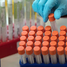 Residue 487 is a threonine in strain htor02 but is a serine in the other strains isolated from humans and civets. Studie Zur Corona Mutation Offenbart Bisherige Massnahmen Reichen Wohl Nicht Aus Welt