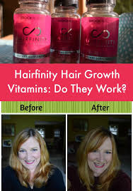 For example, biotin is one of several b vitamins that support a healthy metabolism. Hairfinity Vitamins For Hair Growth Review And Results Beauty And Fashion Tech